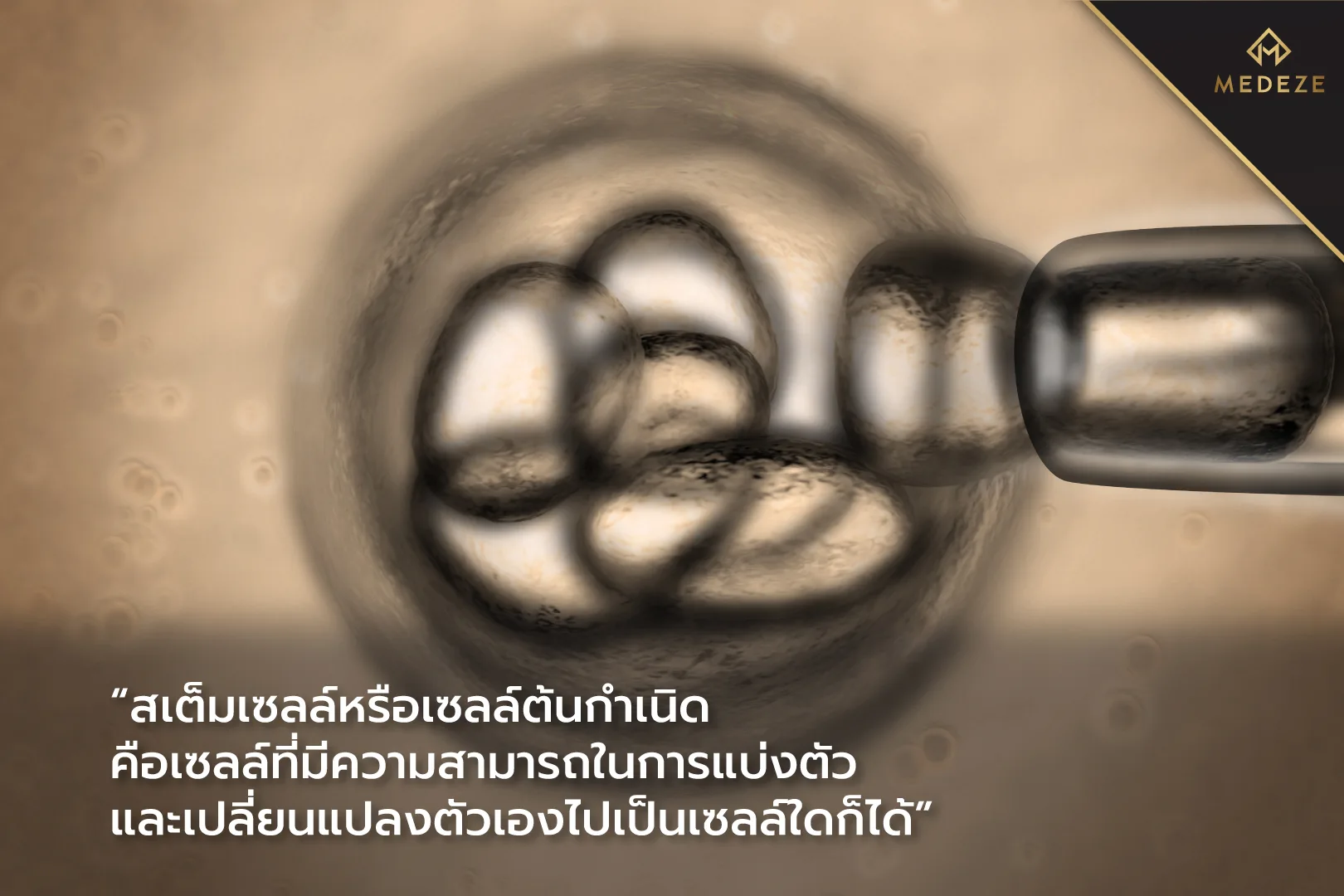 การเก็บสเต็มเซลล์มีกี่แบบ สามารถเก็บได้จากที่ไหนบ้างและแตกต่างกันอย่างไร