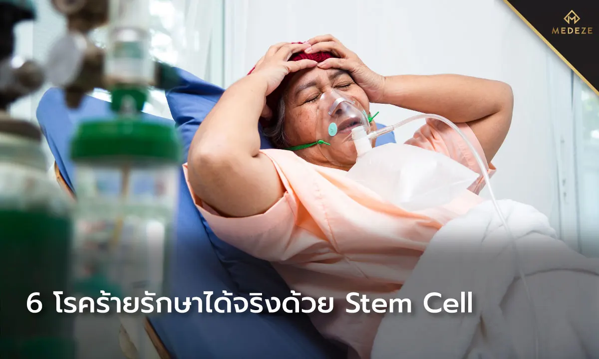 Stem Cell