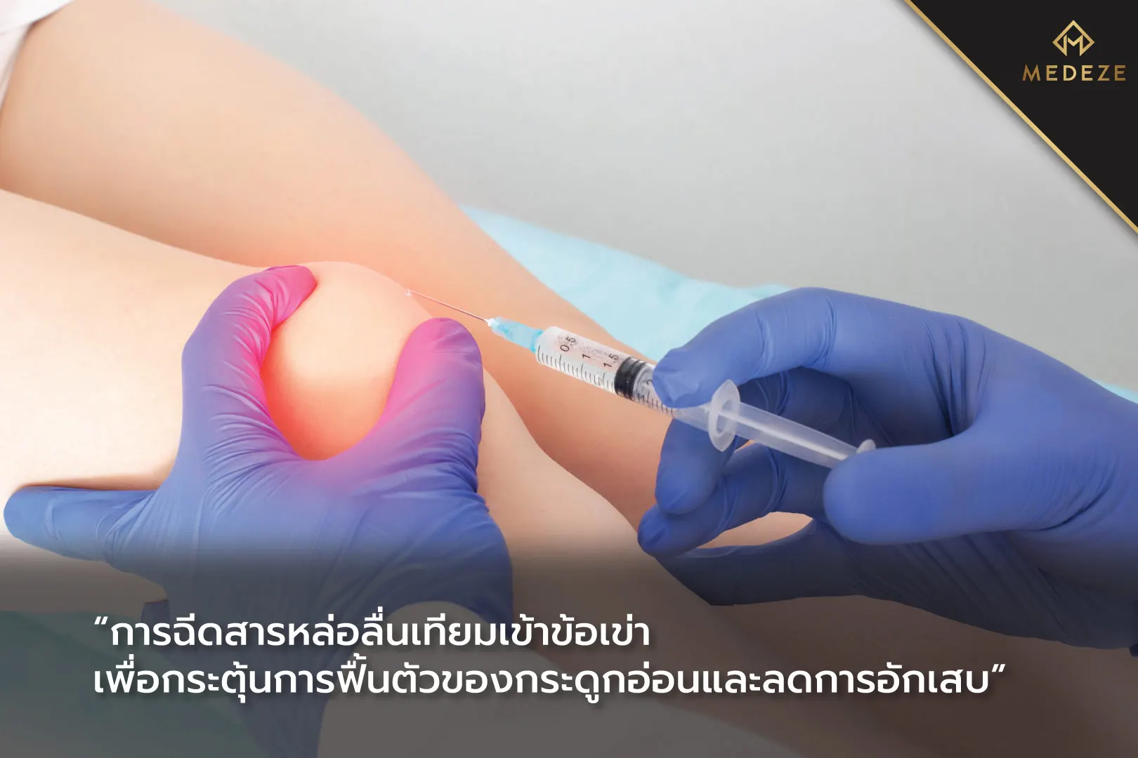 โรคข้อเข่าเสื่อม