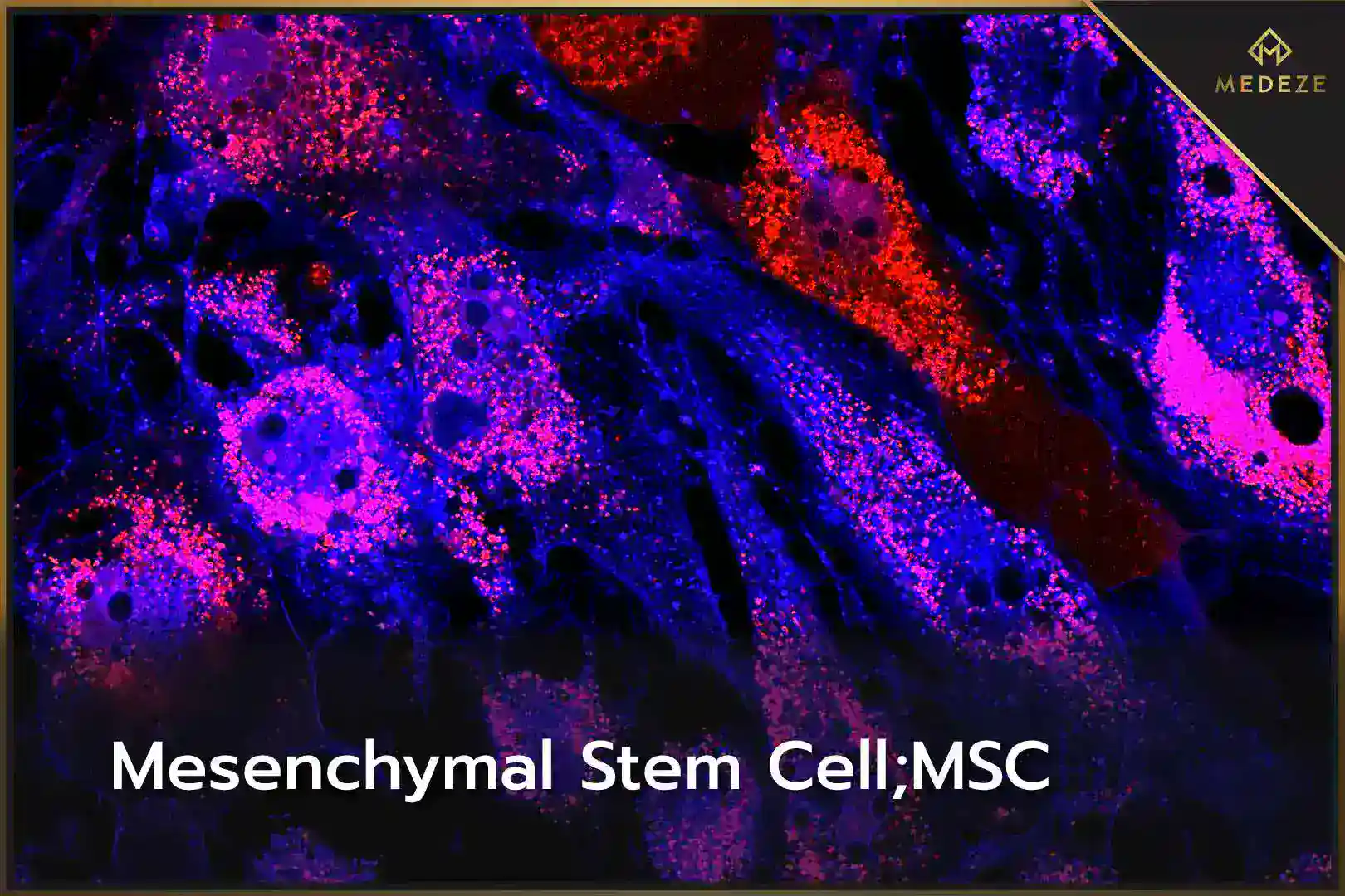 Mesenchymal Stem Cell
